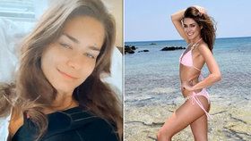 Karolína Kokešová, která získala korunku Miss Global: Po vítězství šla na plastiku! Má nové trojky. 