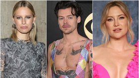 Karolína Kurková nemá pupík, Kate Hudson má šest prstů. Jaké tělesné anomálie trápí další celebrity?