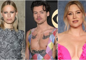 Karolína Kurková nemá pupík, Kate Hudson má šest prstů. Jaké tělesné anomálie trápí další celebrity?