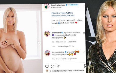 Supermodelka Karolína Kurková (36) je těhotná! Bude nás pět, oznámila a odhalila se