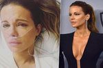 Herečka Kate Beckinsaleová skončila v nemocnici poté, co jí praskla cysta!