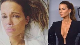 Herečka Kate Beckinsaleová skončila v nemocnici poté, co jí praskla cysta!