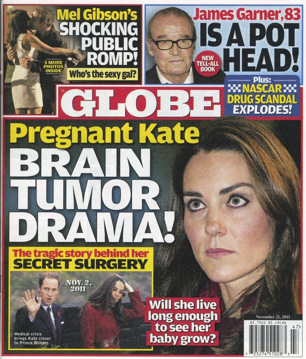 Americký magazín také tvrdil, že Kate Middleton má nádor na mozku!