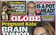 Podle amerického časopisu Globe Kate bojuje s nádorem v mozku.