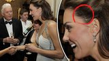 Vyhublá Kate ukázala jizvu z dětství