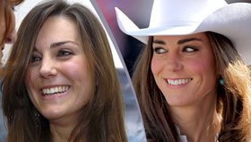 Kate si díky chirurgovi výrazně polepšíla. Vlevo fotografie z roku 2009, vpravo z roku 2011.