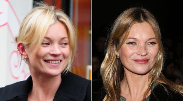 Kate Moss je pořád kočka, ale obličej jí zničil kokain.