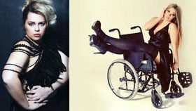 Katie Knowles se navzdory svému handicapu stala modelkou a slaví úspěch.