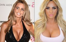 Katie Price vystavila svou silikonovou chloubu: Kokosy na slunci