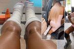 Katie Priceová po operaci zlámaných nohou: Plazením vpřed!