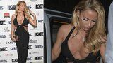 Modelka Katie Price vystavila na odiv své zjizvené „melouny“ 