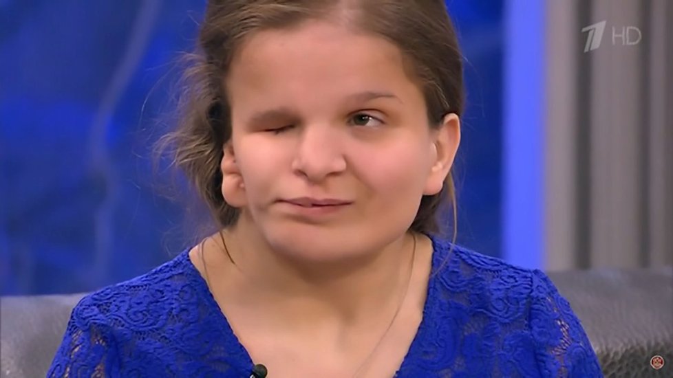 Katje (†17) matka řekla, že ji vezme zpět, když půjde na plastiku. Dívka po operaci zemřela.