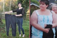 Obézní žena zhubla neuvěřitelných 76 kilo: Co ji k tomu přimělo?