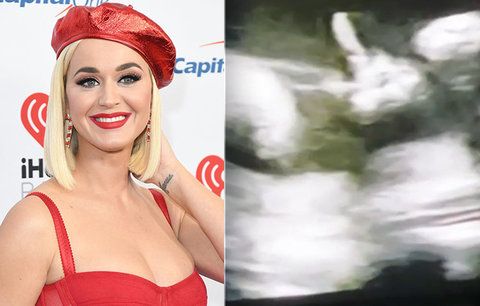 Šokující ultrazvuk zpěvačky Katy Perry: Nenarozená dcera udělala něco nevídaného!