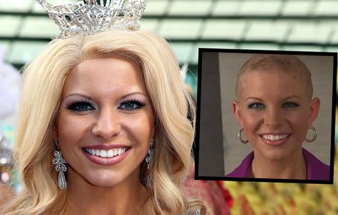 Plešatá kráska chce být Miss America