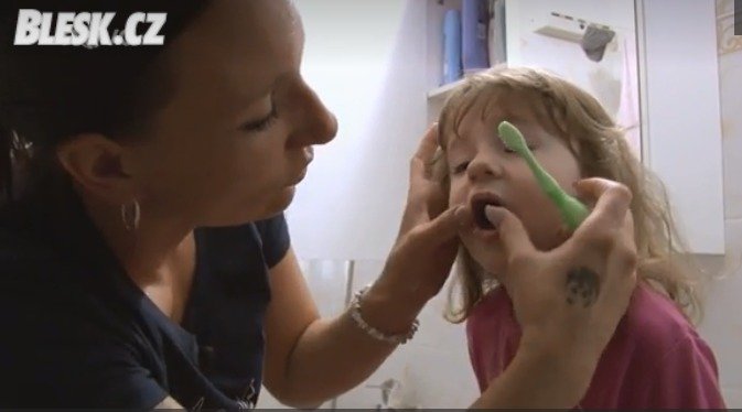 Náhradní maminka Štěpánka (32) byla v šoku, když šla malé Vanesce (2) čistit zuby. Holčičky chrup byl celý černý a zkažený