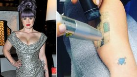 Kelly Osbourne si nechává odstraňovat svá tetování a stěžuje si, jak moc to bolí