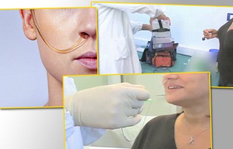 Nejextrémnější dieta všech dob: 10 dnů s hadičkou v nose a čerpadlem v batohu