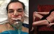 Rodrigo Alves je posedlý plastikami. Rodrigo Alves je posedlý plastikami.