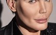 Rodrigo Alves je posedlý plastikami. Rodrigo Alves je posedlý plastikami.