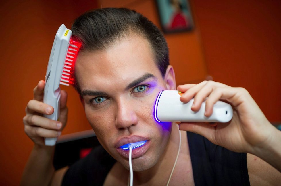 Rodrigo Alves je posedlý plastikami.