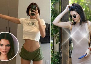 Podstoupila Kendall Jenner plastiku prsou?