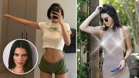 Podstoupila Kendall Jenner plastiku prsou?