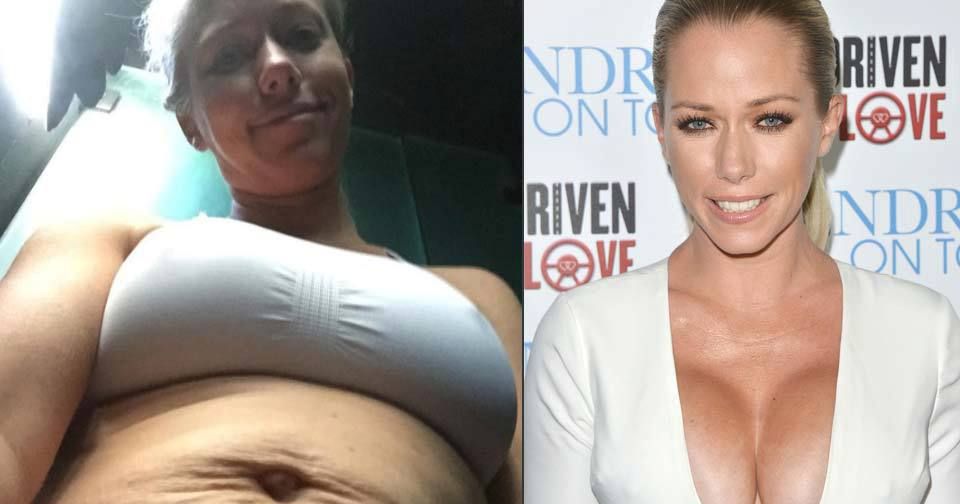 Playmate Kendra Wilkinson (31) ukázala své bříško po porodu. Od fanoušků se dočkala více než pozitivní odezvy!