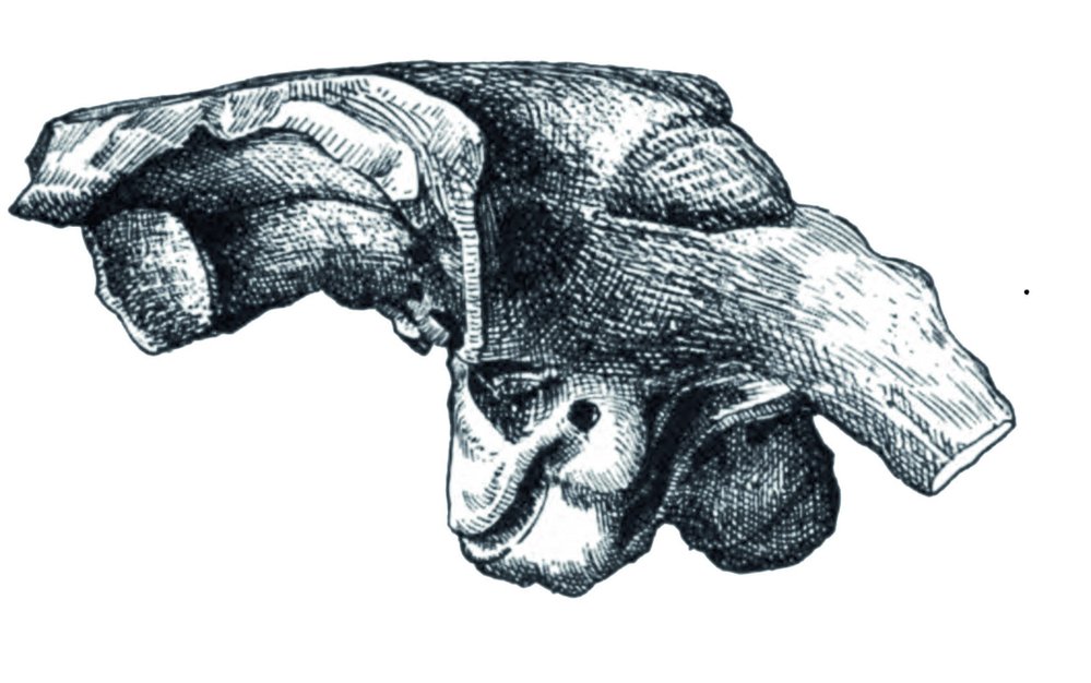 Výlitek mozkovny (kentrosaura)
