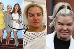 Kerry Katona z Atomic Kitten po plastice víček