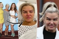 Bývalá hvězda Atomic Kitten předvedla opuchlou tvář: Komplikace s poškrábanou rohovkou!