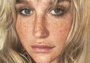 Kesha