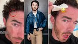 Kevin z Jonas Brothers přiznal rakovinu kůže: Bazaliom na čele!