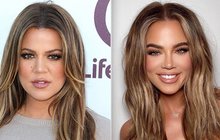 Khloé Kardashianová šla s pravdou ven: Tolik má plastik! 