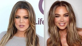 Není to někdo jiný? Khloe Kardashianová si už po plastikách není podobná!