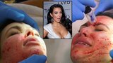 Kim Kauuuurdashian: Sexbomba podstoupila bolestivou plastickou operaci!