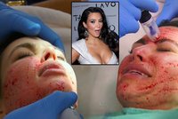 Kim Kauuuurdashian: Sexbomba podstoupila bolestivou plastickou operaci!