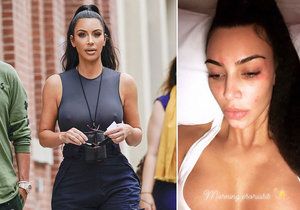 Věčně dokonalá Kim Kardashianová bojuje se zákeřnou nemocí!