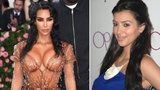 Milionová proměna Kim Kardashianové: Neuvěříte, kolik utratila za plastiky! 