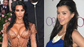 Milionová proměna Kim Kardashianové! Kolik utratila za plastiky a co všechno si nechala upravit?
