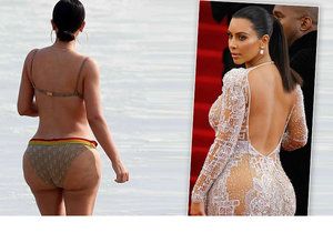 Podle plastického chirurga Aardona Rollinse, který podle svých slov pracoval i na Kim Kardashian, už tato hvězda se svým pozadím zašla příliš daleko.