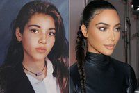 Kim Kardashianová plastiky už nezapře! FOTO ji prozradilo