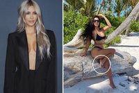 Trapas královny retuší Kim Kardashianové: Kvůli sexy fotce z pláže přišla o prst!