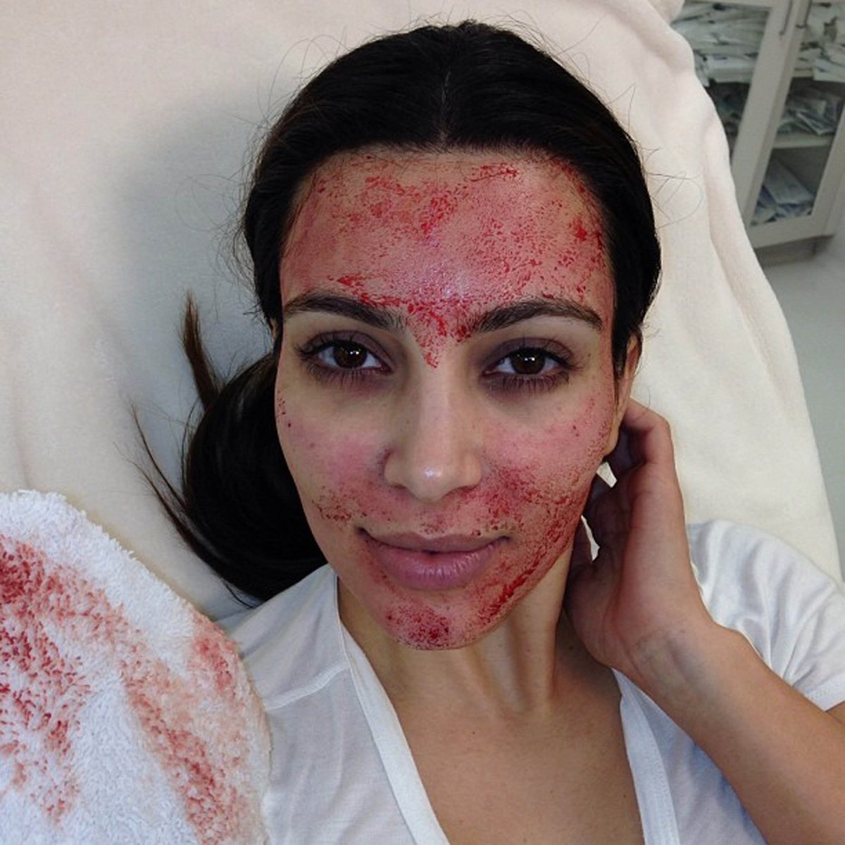 Kim Kardashian se omlazuje vlastní krví