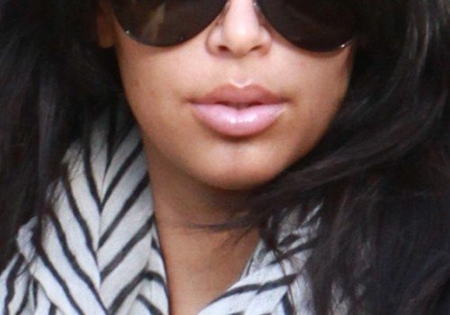 Kim Kardashian botox nezapře