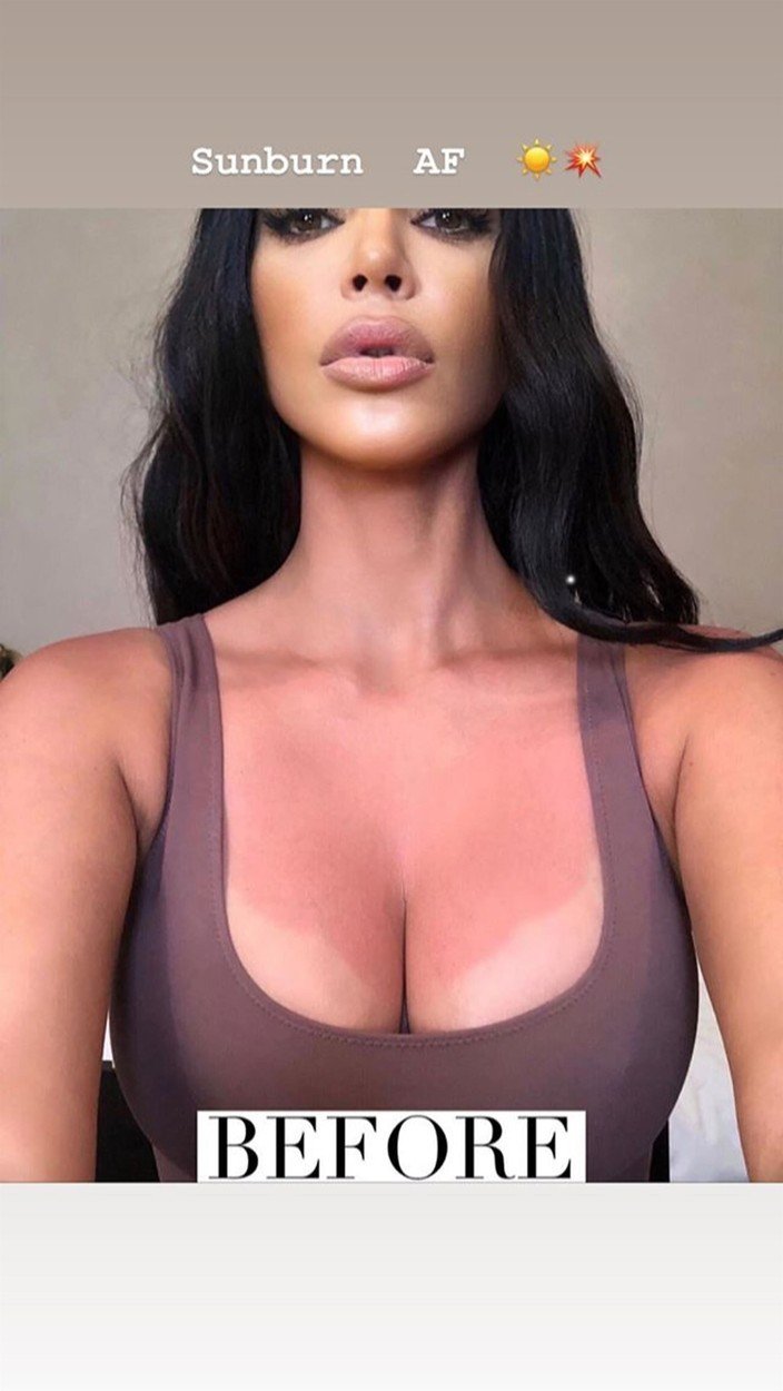 Kim Kardashianová vypnula rudou hruď do objektivu Totálně spálená, napsala k fotce