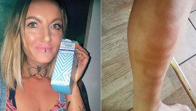Nešťastné opálení pravé blondýnky: Kimberley (36) použila samoopalovák a šla do posilovny. Na nohu se jí obtiskl nápis »Adidas«.