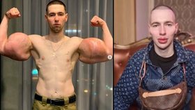 Bývalý ruský voják Kirill Terešin (25) chce vypadat jako mimozemšťan. Nechal si napíchat rty a tváře.