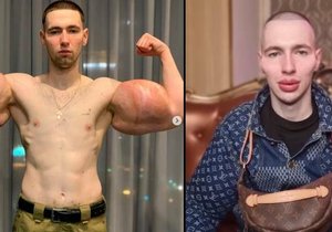 Bývalý ruský voják Kirill Terešin (25) chce vypadat jako mimozemšťan. Nechal si napíchat rty a tváře.