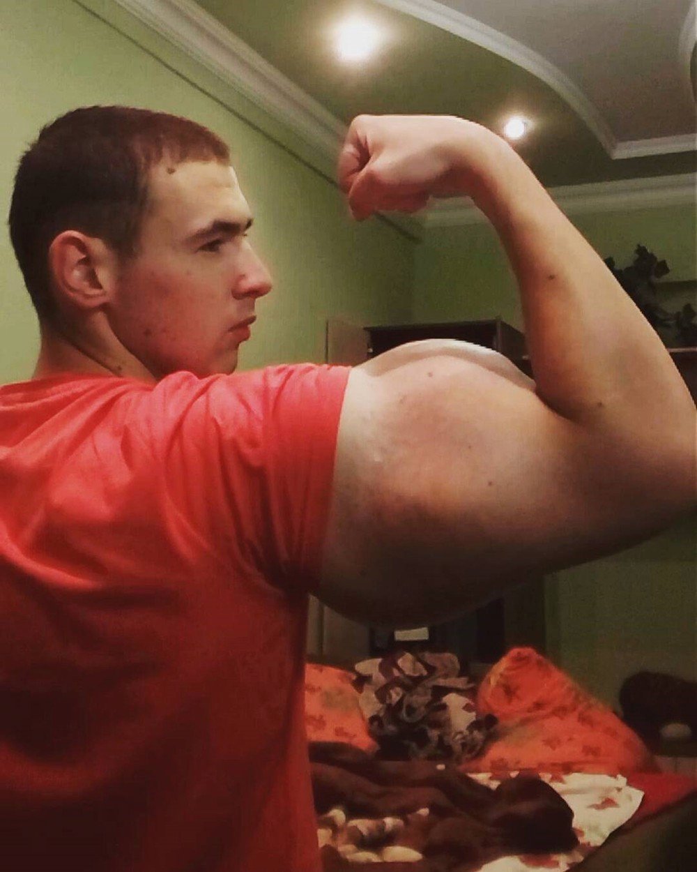 Kirill Tereshin (21) z Ruska si do svalů píchá nebezpečný olej, aby zlomil rekord v kulturistice